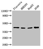 HSD3B1 Antibody in Western Blot (WB)