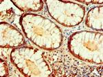 IDH1 Antibody in Immunohistochemistry (Paraffin) (IHC (P))