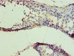 IDH1 Antibody in Immunohistochemistry (Paraffin) (IHC (P))