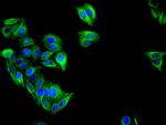 IFIT3 Antibody in Immunocytochemistry (ICC/IF)