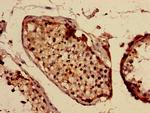 Interferon alpha-10 Antibody in Immunohistochemistry (Paraffin) (IHC (P))