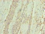 CD127 Antibody in Immunohistochemistry (Paraffin) (IHC (P))