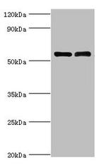 CD127 Antibody in Western Blot (WB)