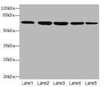 ILVBL Antibody in Western Blot (WB)