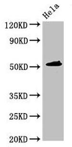 IP6K1 Antibody in Western Blot (WB)