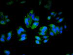 CD11a Antibody in Immunocytochemistry (ICC/IF)