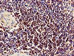 CD11a Antibody in Immunohistochemistry (Paraffin) (IHC (P))