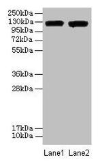 CD11a Antibody in Western Blot (WB)