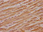 ITGB1BP1 Antibody in Immunohistochemistry (Paraffin) (IHC (P))