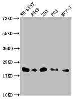 ITGB1BP1 Antibody in Western Blot (WB)