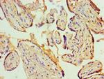 KCNN4 Antibody in Immunohistochemistry (Paraffin) (IHC (P))