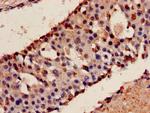 KEAP1 Antibody in Immunohistochemistry (Paraffin) (IHC (P))