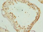 KIF3A Antibody in Immunohistochemistry (Paraffin) (IHC (P))