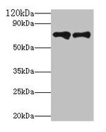 Plasma Kallikrein Antibody in Western Blot (WB)