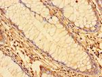 KPNA2 Antibody in Immunohistochemistry (Paraffin) (IHC (P))