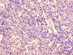 KPNA2 Antibody in Immunohistochemistry (Paraffin) (IHC (P))