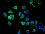 Cytokeratin 10 Antibody in Immunocytochemistry (ICC/IF)