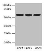 Cytokeratin 10 Antibody in Western Blot (WB)