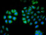 L-Plastin Antibody in Immunocytochemistry (ICC/IF)