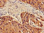 L-Plastin Antibody in Immunohistochemistry (Paraffin) (IHC (P))