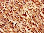 Galectin 1 Antibody in Immunohistochemistry (Paraffin) (IHC (P))