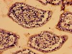 LIAS Antibody in Immunohistochemistry (Paraffin) (IHC (P))