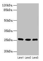 LIN7A Antibody in Western Blot (WB)