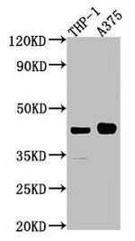 RAP Antibody in Western Blot (WB)