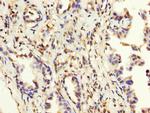 MAGEA3 Antibody in Immunohistochemistry (Paraffin) (IHC (P))