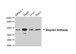 MAP2K4 Antibody in Western Blot (WB)