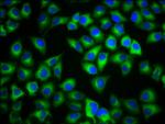 MC1R Antibody in Immunocytochemistry (ICC/IF)