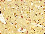 MC1R Antibody in Immunohistochemistry (Paraffin) (IHC (P))