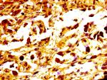 MC1R Antibody in Immunohistochemistry (Paraffin) (IHC (P))