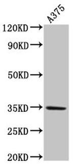 MC1R Antibody in Western Blot (WB)