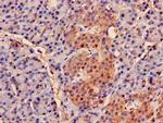 PSMB2 Antibody in Immunohistochemistry (Paraffin) (IHC (P))