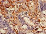 Melanophilin Antibody in Immunohistochemistry (Paraffin) (IHC (P))