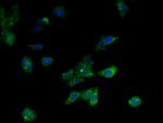 MCD Antibody in Immunocytochemistry (ICC/IF)