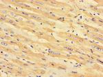 MCD Antibody in Immunohistochemistry (Paraffin) (IHC (P))