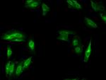 MSH4 Antibody in Immunocytochemistry (ICC/IF)