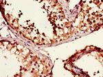 MSH4 Antibody in Immunohistochemistry (Paraffin) (IHC (P))