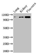 MSH4 Antibody in Western Blot (WB)