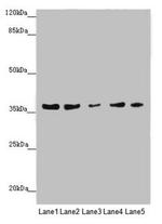 MTHFD2 Antibody in Western Blot (WB)