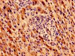 MTRF1 Antibody in Immunohistochemistry (Paraffin) (IHC (P))