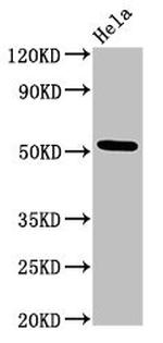 MTRF1 Antibody in Western Blot (WB)