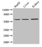 NAPRT1 Antibody in Western Blot (WB)