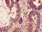 NDUFS4 Antibody in Immunohistochemistry (Paraffin) (IHC (P))