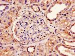 NDUFS4 Antibody in Immunohistochemistry (Paraffin) (IHC (P))