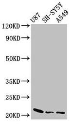 NDUFS4 Antibody in Western Blot (WB)