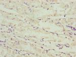 NDUFS6 Antibody in Immunohistochemistry (Paraffin) (IHC (P))