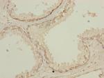 NMT2 Antibody in Immunohistochemistry (Paraffin) (IHC (P))